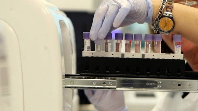 Coronavirus, D’Urso: “Arezzo autonoma nell’analisi del tampone, più rapidi ed efficienti”