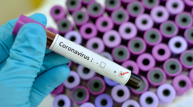 1585330025_coronavirus-test-tampone-278039.660×368