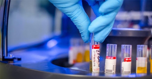 Coronavirus Arezzo, 5 nuovi casi: uno in città, 4 in Valdarno. La media resta del 2%