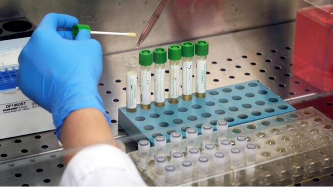 1587565625_test-sierologici-coronavirus