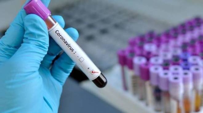 1588953733_coronavirus