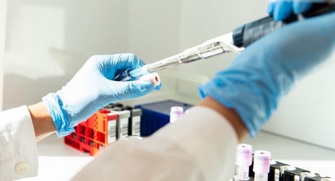 1594736688_analisi-tamponi-coronavirus