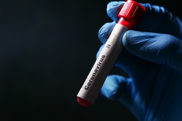 1604153984_laboratory-technician-hand-holding-blood-test-tube_260672-571