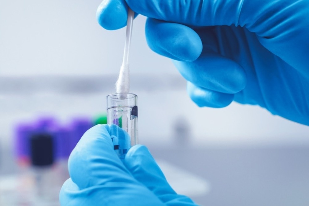 1641917510_1603387602_coronavirus-tampone_o